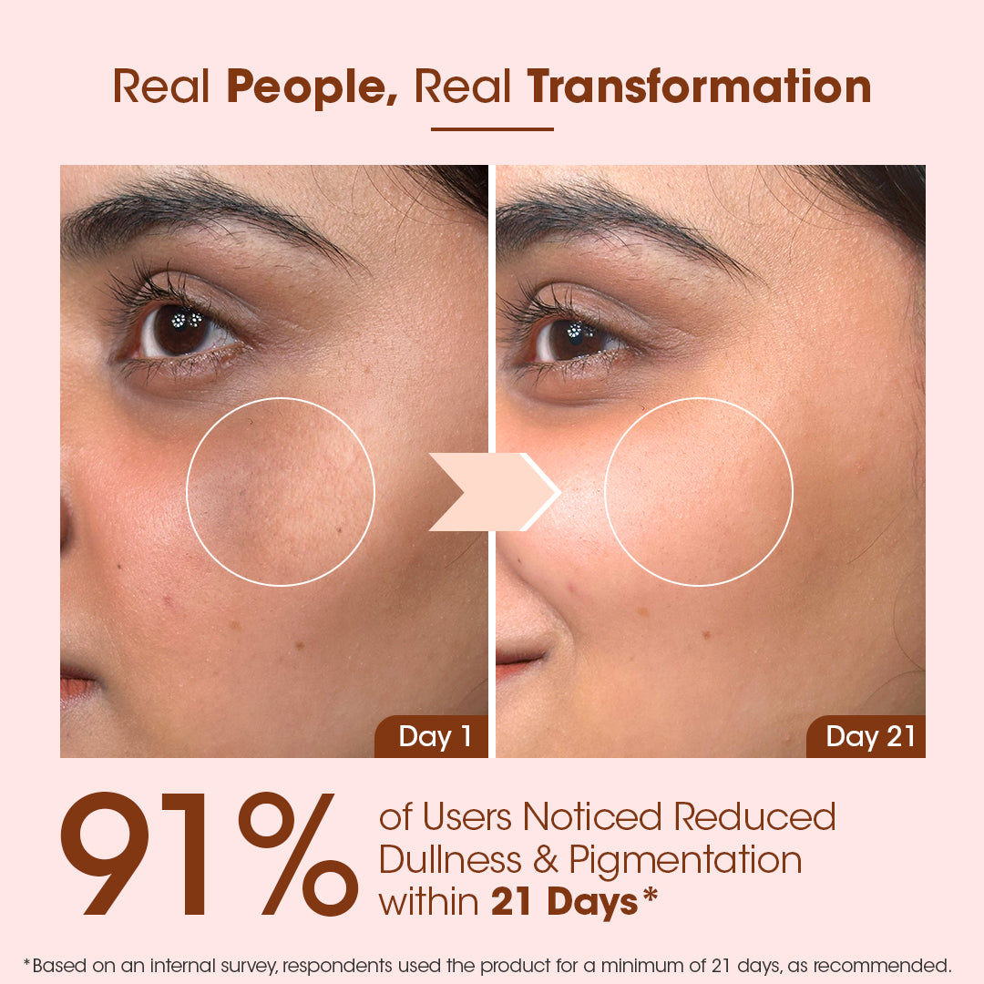 Kumkumadi Day Cream and Night Gel Combo