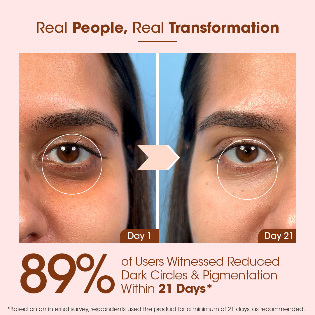 Kumkumadi Under Eye Serum