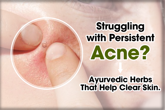 Struggling with Persistent Acne? Ayurvedic Herbs That Help Clear Skin