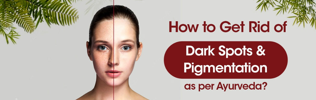 How to Get Rid of Dark Spots and Pigmentation as per Ayurveda?