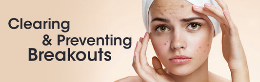 Banishing Blackheads: Strategies for Clearing and Preventing Breakouts