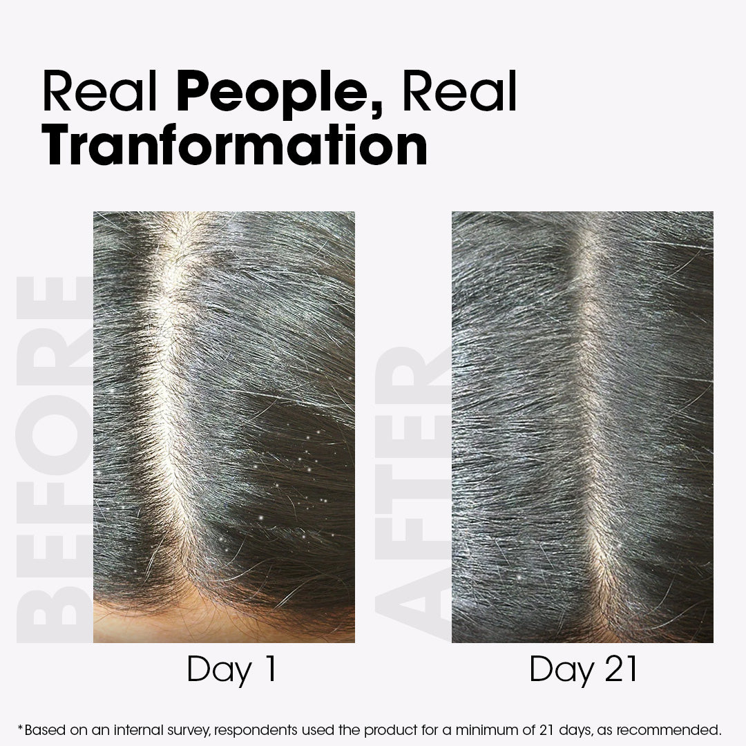 Methi Anti-Dandruff Hair Shampoo