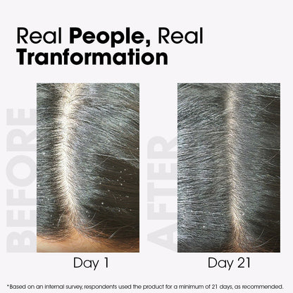 Methi Anti-Dandruff Hair Shampoo
