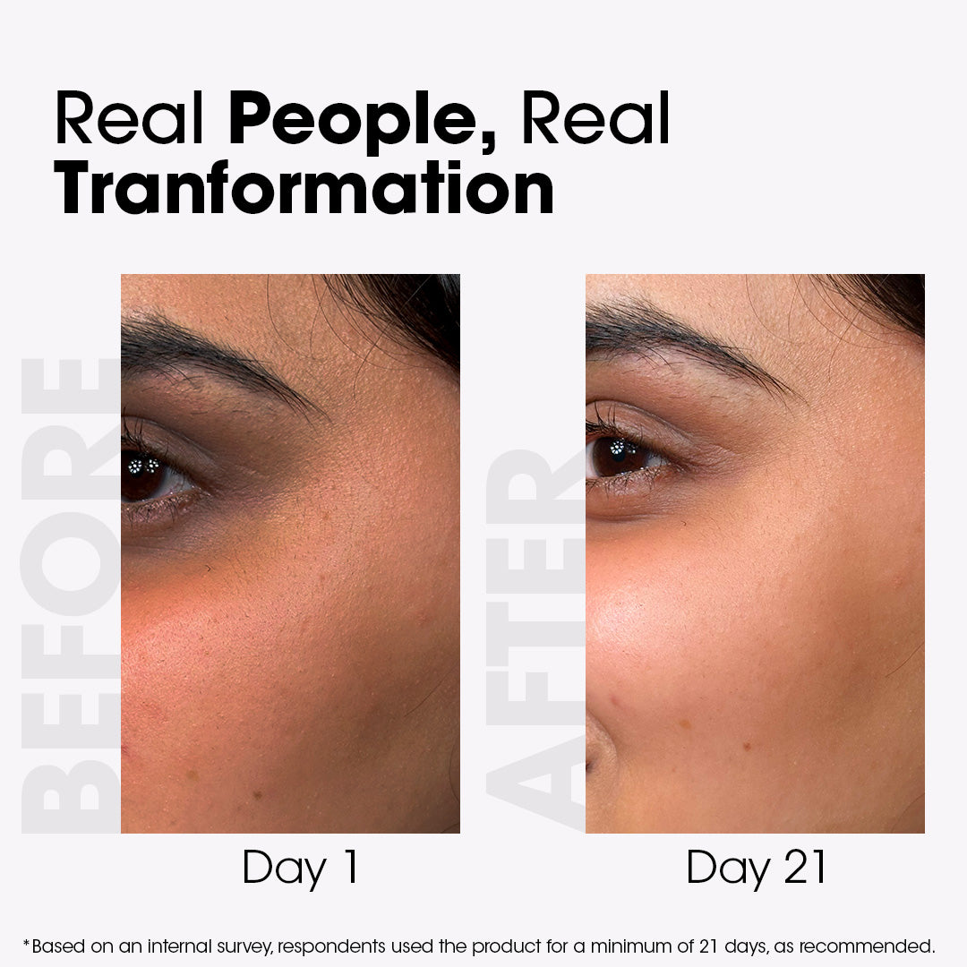 Acne & Spot Correction Face Serum