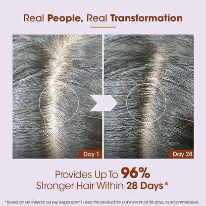 Rosemary Anti-Hair Fall Scalp Serum